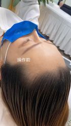 -MISS STAR·半永久纹眉·发际线·美瞳线