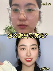 -坤如玛丽·医疗美容中心