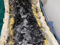 -张钰强中医正骨推拿连锁(唐家人才公寓店)