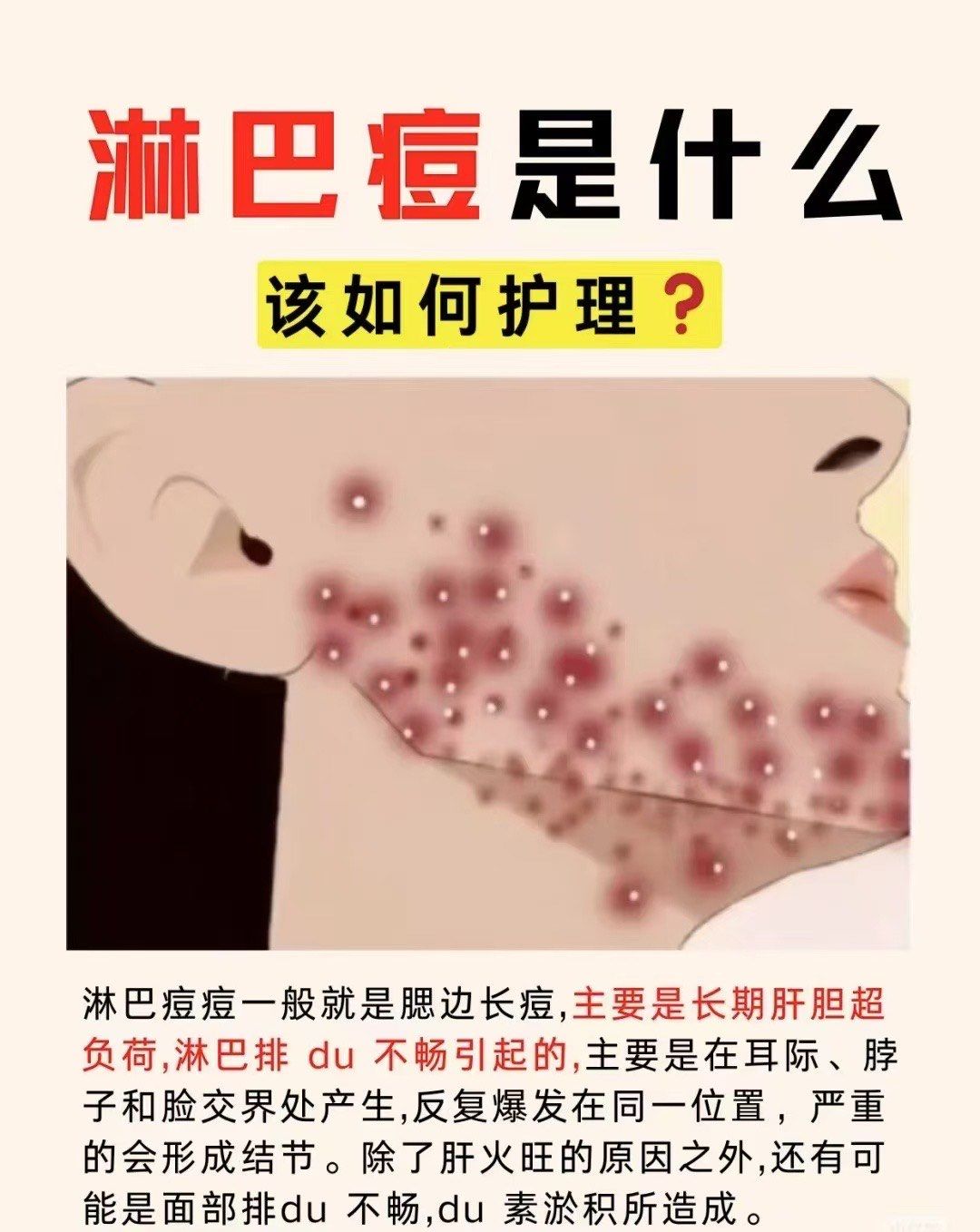 伊妍雅肌 面部排毒