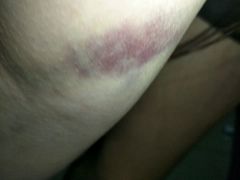 -北京中西医结合医院