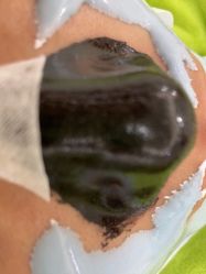 -苗医生草本科技祛痘