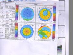 -武汉大学附属爱尔眼科医院(湖北总院)