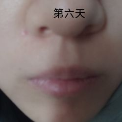 -北京米扬丽格医疗美容·联合丽格鼻整形中心