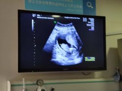 -杭州贝瑞斯美华妇儿医院·早孕·产检·儿科