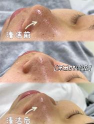 -LUNA皮相美·骨相美高级美感