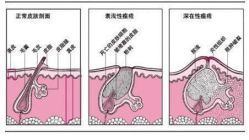 -蕾特恩·专业祛痘国际连锁