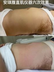 -美丽妈妈产后恢复中心(南桥旗舰店)