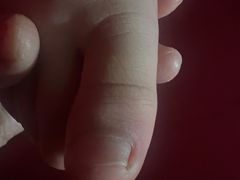 -Andrew指甲专科灰指甲·甲沟炎矫正·3D步态矫形鞋垫定制(上海法华镇路旗舰店)
