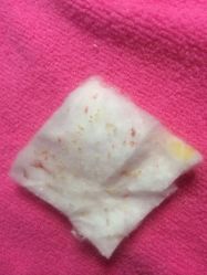 -成都苗方清颜专业祛痘