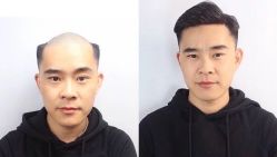 -发饰美男士增发补发假发定制店