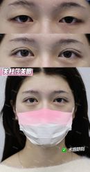 -长沙雅美医疗美容医院