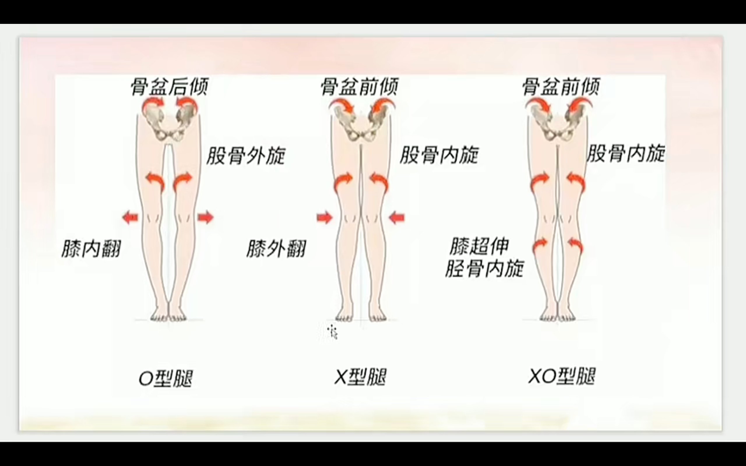 女生大腿外侧肌肉外扩图片