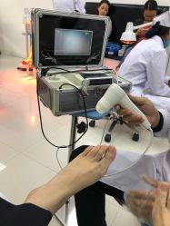 -派恩宜灰指甲鸡眼嵌甲手足癣