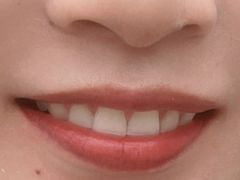 -美酷口腔牙齿矫正(江桥万达店)
