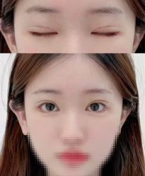 -东莞西妃整形美容医院