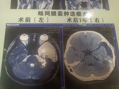 -中国医科大学附属盛京医院(南湖院区)
