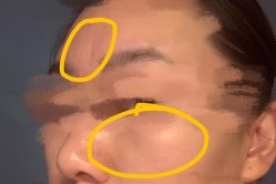 -纯粹医美