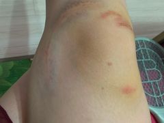 -合肥滨湖国家森林公园