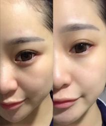 -上海时光整形外科医院