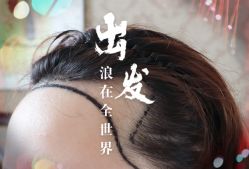 -大麦微针植发全国连锁