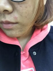 -皇族养心堂·净痘·修敏·御颜