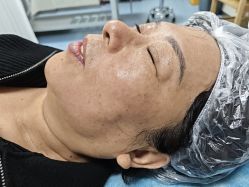 -长沙雅美医疗美容医院