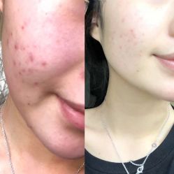 -苗方清颜痘肌研究所