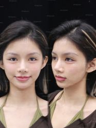 -深圳艺星医疗美容医院