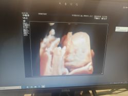 -米诺娃妇女儿童医院·三级妇儿医院