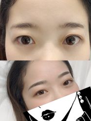 -MIVI半永久纹眉绣眉