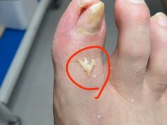 -世龙世家甲沟炎·灰指甲·嵌甲矫正·修脚(武侯区双楠店)