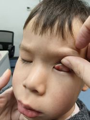 -首都医科大学附属北京儿童医院