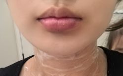 -海涛医疗美容·面部抗衰·注射美鼻