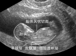 -邢台妇产医院