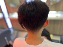 -大麦微针植发丨全国连锁