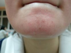 -素妍印象Ekrin Medi Clinic