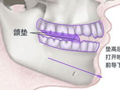 -团圆口腔·种植中心(锦江院区)
