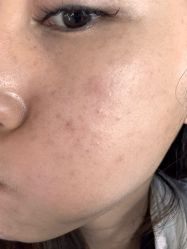 体验前-深圳美莱医疗美容医院