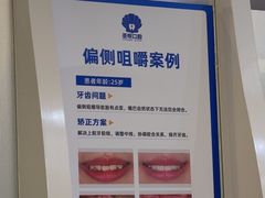 -圣呗口腔·舒适化种植牙·矫正中心(广州总院)