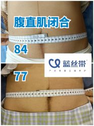 -蓝丝带产后恢复中心(都江堰店)