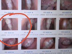 -极橙儿童齿科矫正中心(奥城店)