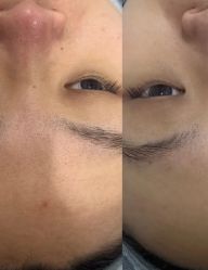 -SKIN79皮肤管理中心