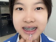 -圣呗口腔·舒适化种植牙·矫正中心(广州总院)