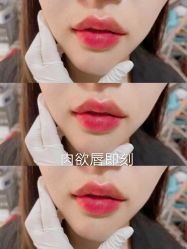 -上海漾颜医疗美容