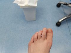 -Andrew指甲专科灰指甲·甲沟炎矫正·3D步态矫形鞋垫定制(上海法华镇路旗舰店)