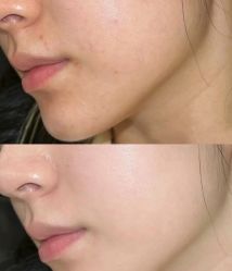 -skin79皮肤管理中心