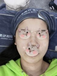 体验后-深圳医恒美医疗美容