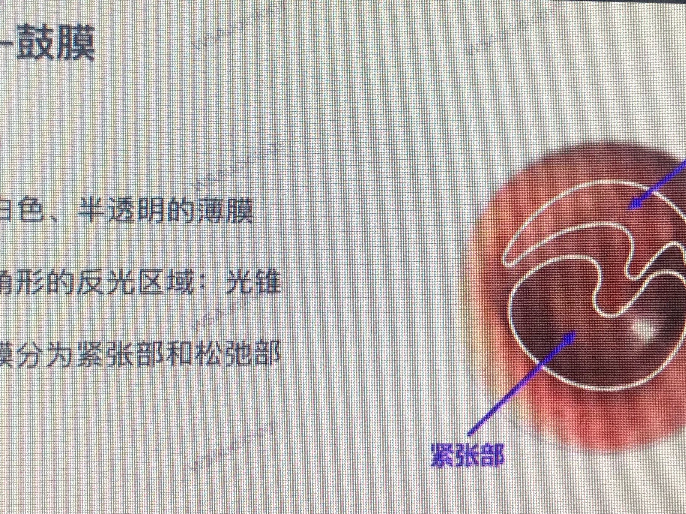 鼓膜紧张部图片图片