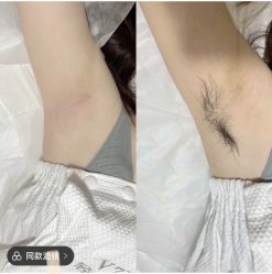 -郡艺医疗美容·微整·眼鼻吸脂